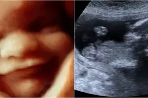 7 Aktivitas bayi di dalam rahim, dari cegukan sampai buang air kecil!