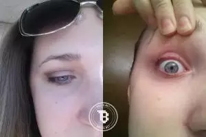 Niat tampil cantik, wanita ini  malah kehilangan bulu matanya, duh! 