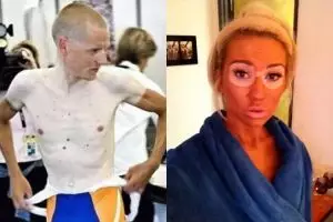 Maunya berkulit eksotis, 15 orang ini malah gagal abis!