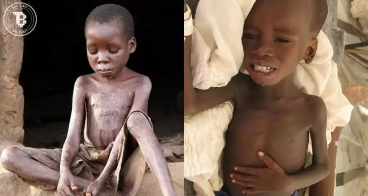 12 Foto anak kelaparan di Afrika ini dijamin bikin air matamu menetes!