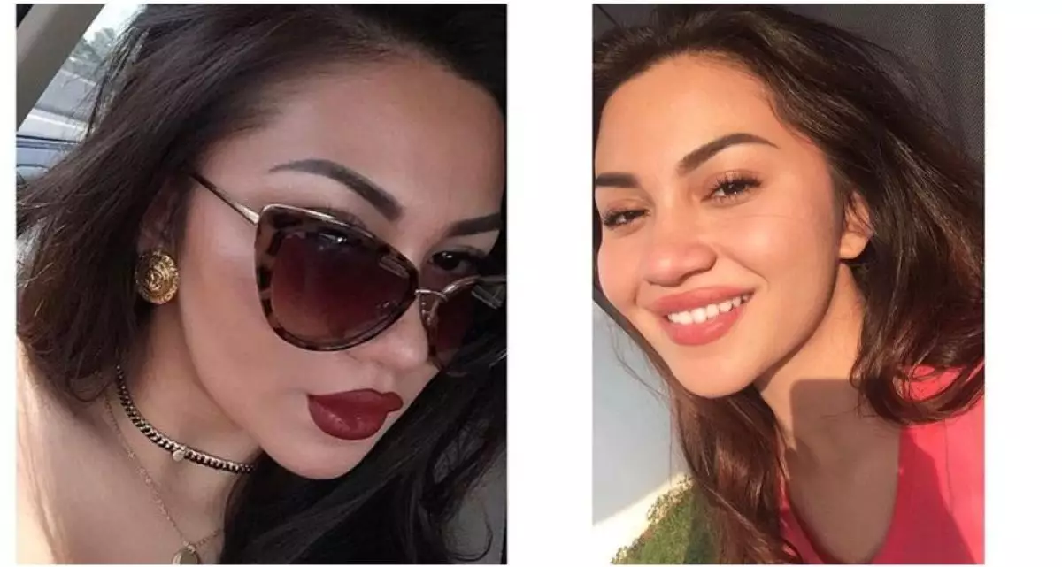 Foto Ariel Tatum ini dibilang seperti digigit semut, kenapa ya?