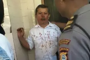 Guru korban pemukulan siswa & orangtua alami patah hidung