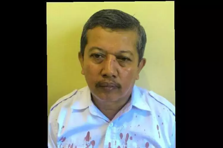 Terungkap kenapa Dasrul, guru SMKN 2 Makassar bisa berdarah-darah