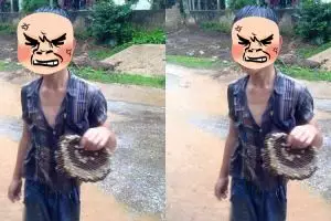 Foto senyuman bocah usai disengat lebah ini mendadak viral, kenapa ya?