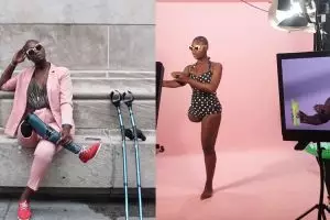 Bangkit pasca amputasi kaki, cewek ini sukses jadi fashion blogger