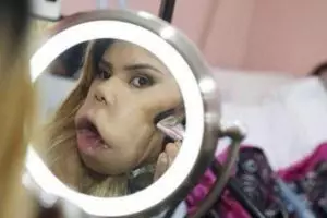 Idap tumor di wajah tak halangi gadis ini menjadi video blogger sukses