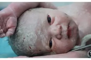 Bayi selamat dari serangan udara di Suriah ini bikin terenyuh