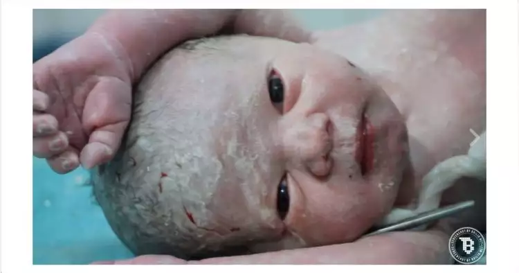 Bayi selamat dari serangan udara di Suriah ini bikin terenyuh