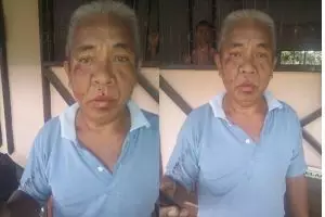 Tak terima anaknya ditegur akibat terlambat, orangtua aniaya guru