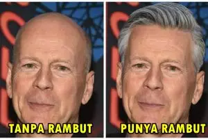 Begini jadinya jika 8 artis Hollywood gundul diedit jadi punya rambut