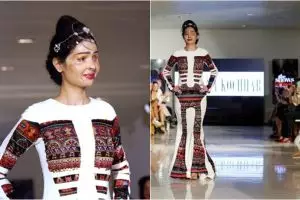 Wajah rusak disiram air keras, wanita ini jadi model kelas dunia