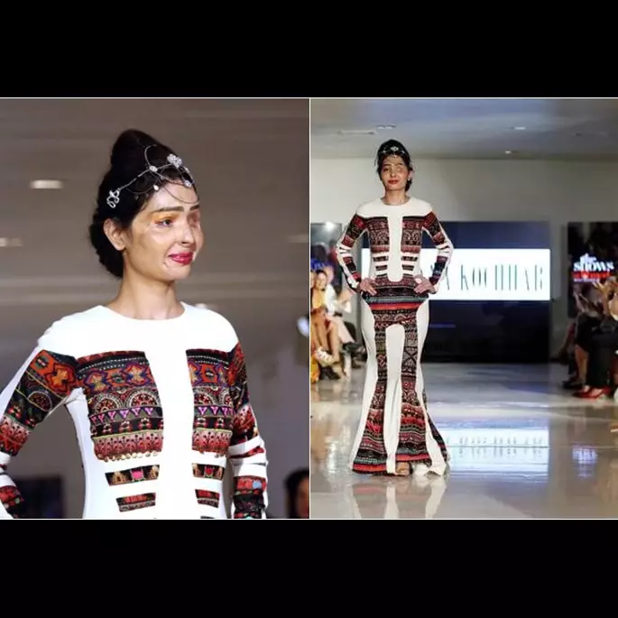 Wajah rusak disiram air keras, wanita ini jadi model kelas dunia