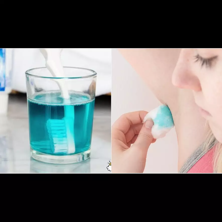 15 Manfaat nggak terduga cairan penyegar mulut, mantap abis