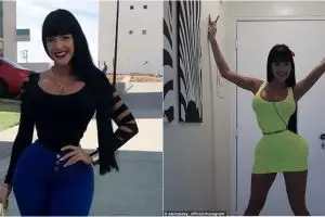 Pakai korset selama 7 tahun, pinggang wanita ini bikin gagal fokus