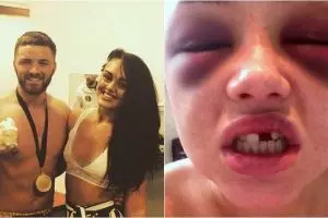 Emosi baca SMS, atlet bela diri ini hajar ceweknya sampai babak belur