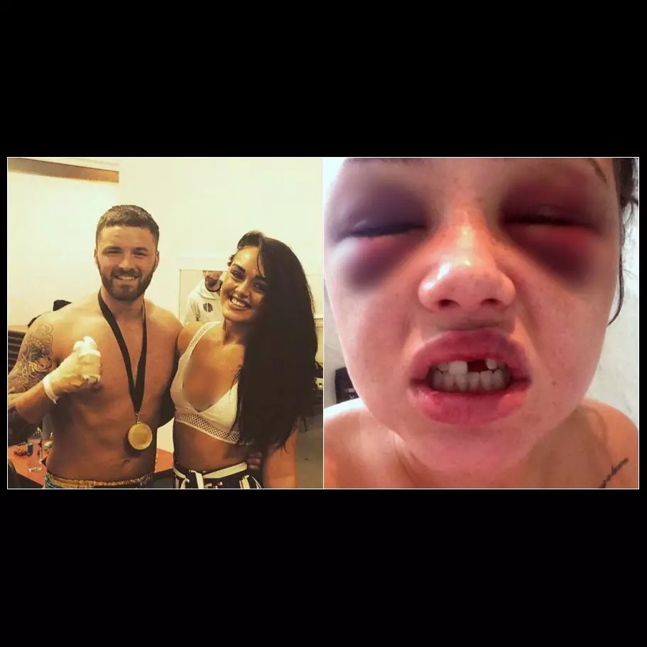 Emosi baca SMS, atlet bela diri ini hajar ceweknya sampai babak belur