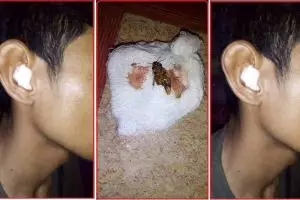 Pria ini guling-guling kesakitan, ada kecoak masuk ke dalam telinganya