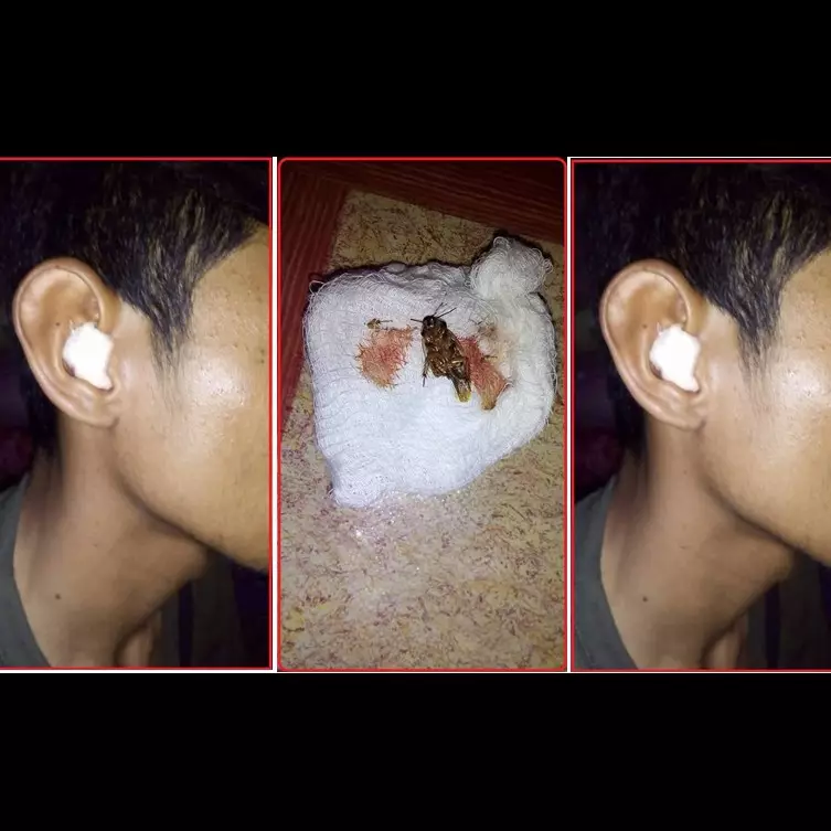 Pria ini guling-guling kesakitan, ada kecoak masuk ke dalam telinganya