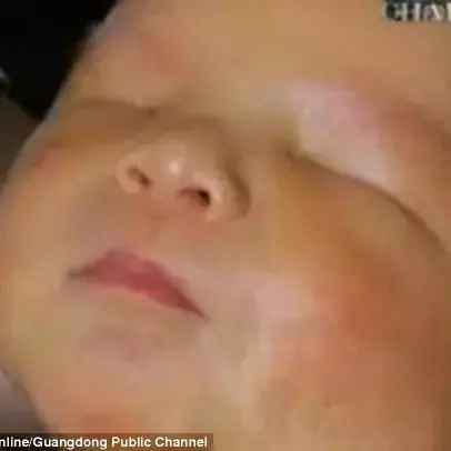 Bayi mungil nan menggemaskan ini lahir tanpa mata