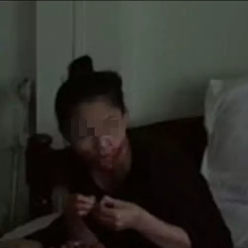 Wanita ini gigit dan telan jari suaminya yang pulang telat