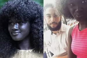 Dijuluki 'si gelap', gadis ini buktikan cantik tak pandang warna kulit