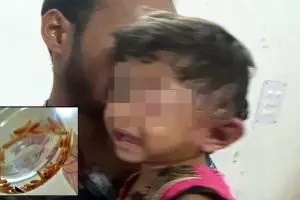 80 Ekor ulat bersarang di telinga bocah ini, sang dokter sampai heran