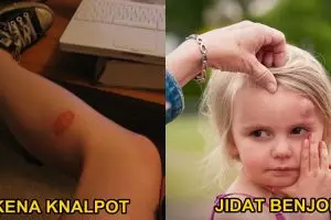 Kalau kamu pernah alami 10 cedera ini, masa kecilmu gereget banget