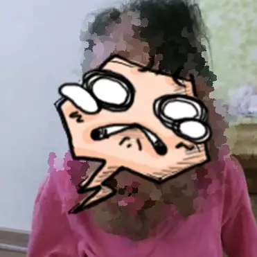 Wanita idap penyakit langka ini bikin netizen ramai salurkan donasi