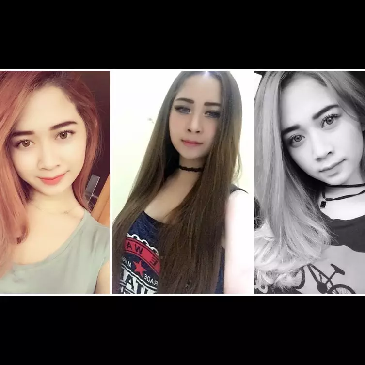 Ini foto-foto Intan Novita, gadis cantik yang disiram air keras, duh