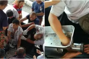 Ngeri, tangan pria ini terjepit di dalam mesin penggiling daging