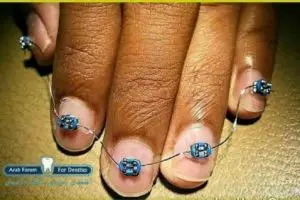 Potret jari tangan usai dibehel ini hasilnya bikin ketawa ngakak