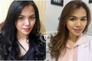 Cantiknya Kalia Labitta, adik Vicky Shu yang berprofesi dokter gigi