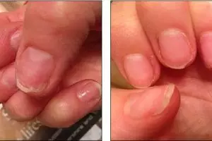 10 Bahaya ini mengancam cewek yang keseringan menicure, hati-hati ya