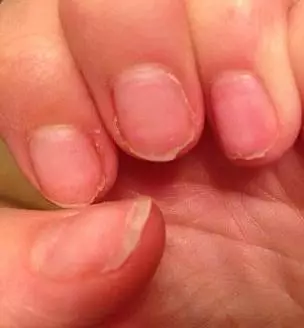 10 Bahaya ini mengancam cewek yang keseringan menicure, hati-hati ya