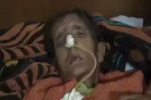 Miris, perempuan tua ini bertahan hidup dengan makan plastik