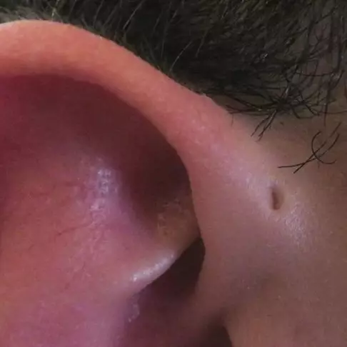 Ada orang dengan 'sisa evolusi insang ikan' di tubuhnya, ini tandanya