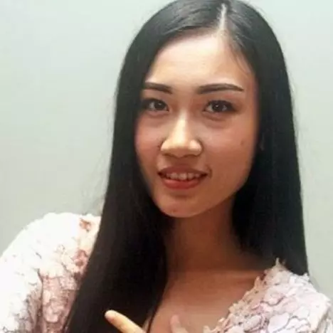 Bikin haru, cewek ini donorkan hati untuk guru SMA-nya