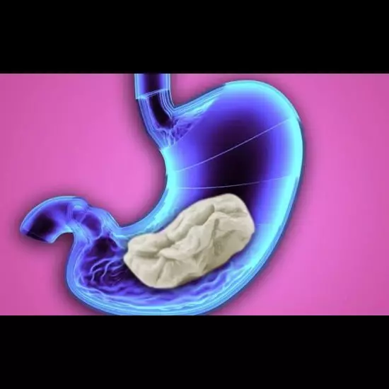 Terjawab sudah, ini yang terjadi kalau kamu menelan permen karet