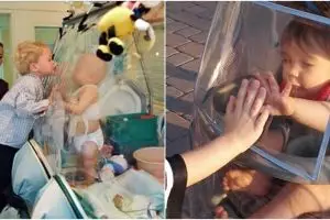 Duh sedihnya, 7 orang ini sejak bayi harus hidup dalam kantong udara