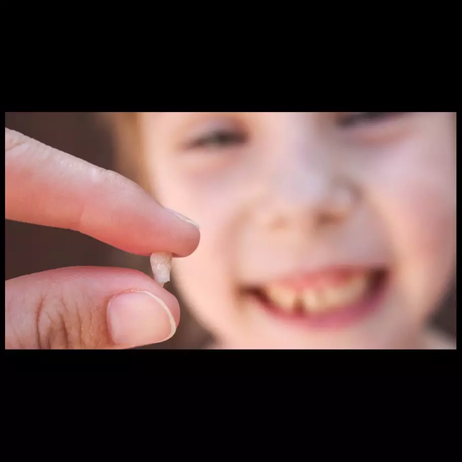 Ini alasan kenapa gigi susu nggak boleh kamu buang setelah copot