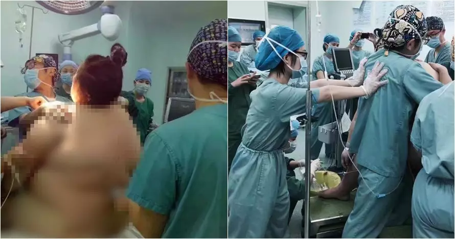 Foto perjuangan ibu dengan BB 127 kg saat melahirkan, bikin deg-degan