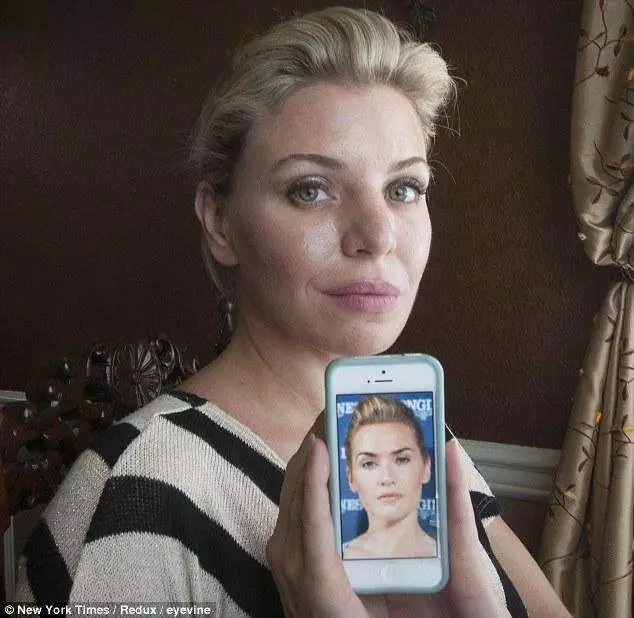 12 Cewek ini ini rela operasi plastik demi mirip artis idolanya