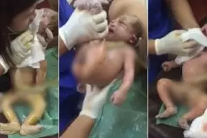 Usaha dokter selamatkan bayi ini bikin tegang dan air mata menetes