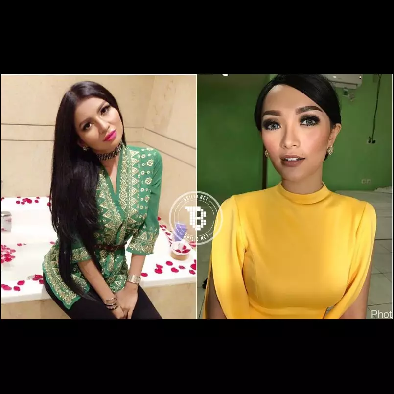 10 Seleb cantik ini blak-blakan lakukan 'tanam benang' demi kecantikan