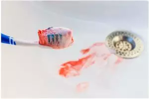 Ini bahaya yang perlu kamu tahu jika berdarah saat sikat gigi