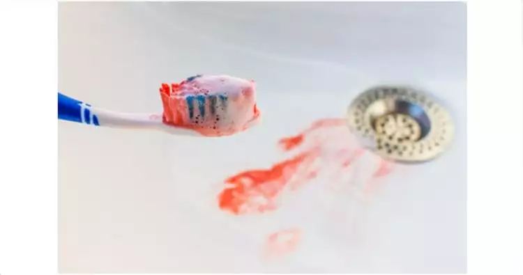 Ini bahaya yang perlu kamu tahu jika berdarah saat sikat gigi