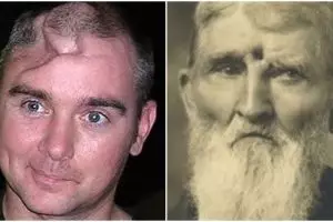 10 Orang ini tetap hidup meski kepalanya tertembak, ajaib! 