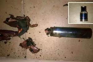 Pria ini kehilangan 7 gigi akibat hisap rokok elektrik, ngeri banget