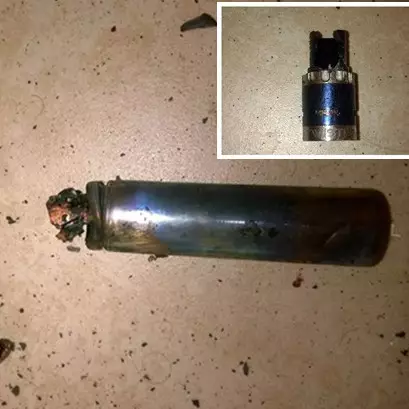 Pria ini kehilangan 7 gigi akibat hisap rokok elektrik, ngeri banget