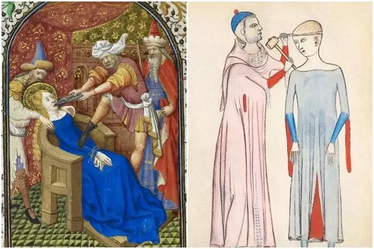 17 Ilustrasi pengobatan abad pertengahan ini bikin kamu susah tidur